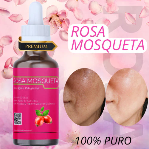 rosa mosqueta